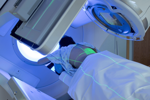 Radioterapia