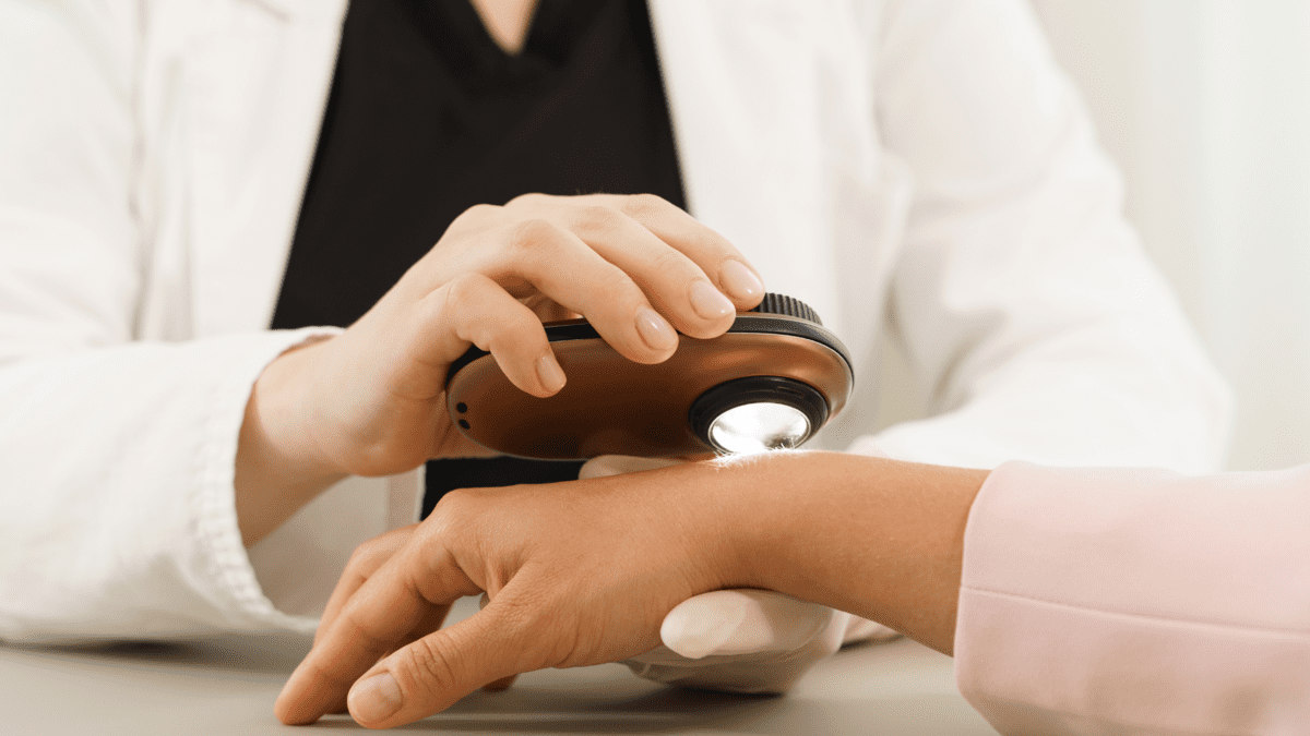 Pruebas de detección de cáncer de piel