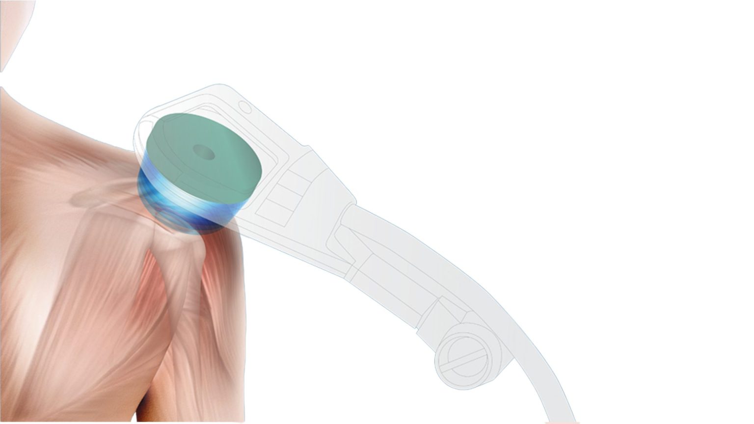 Innovación en rehabilitación y manejo del dolor 4