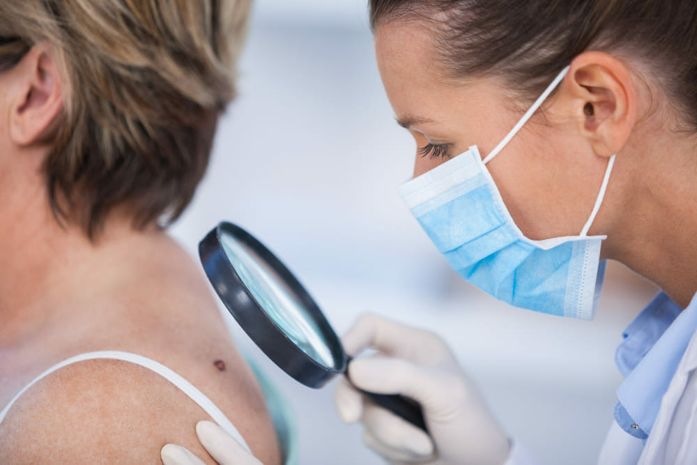 Qué es una biopsia de piel