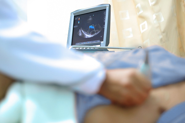 El ecocardiograma hecho por un doctor