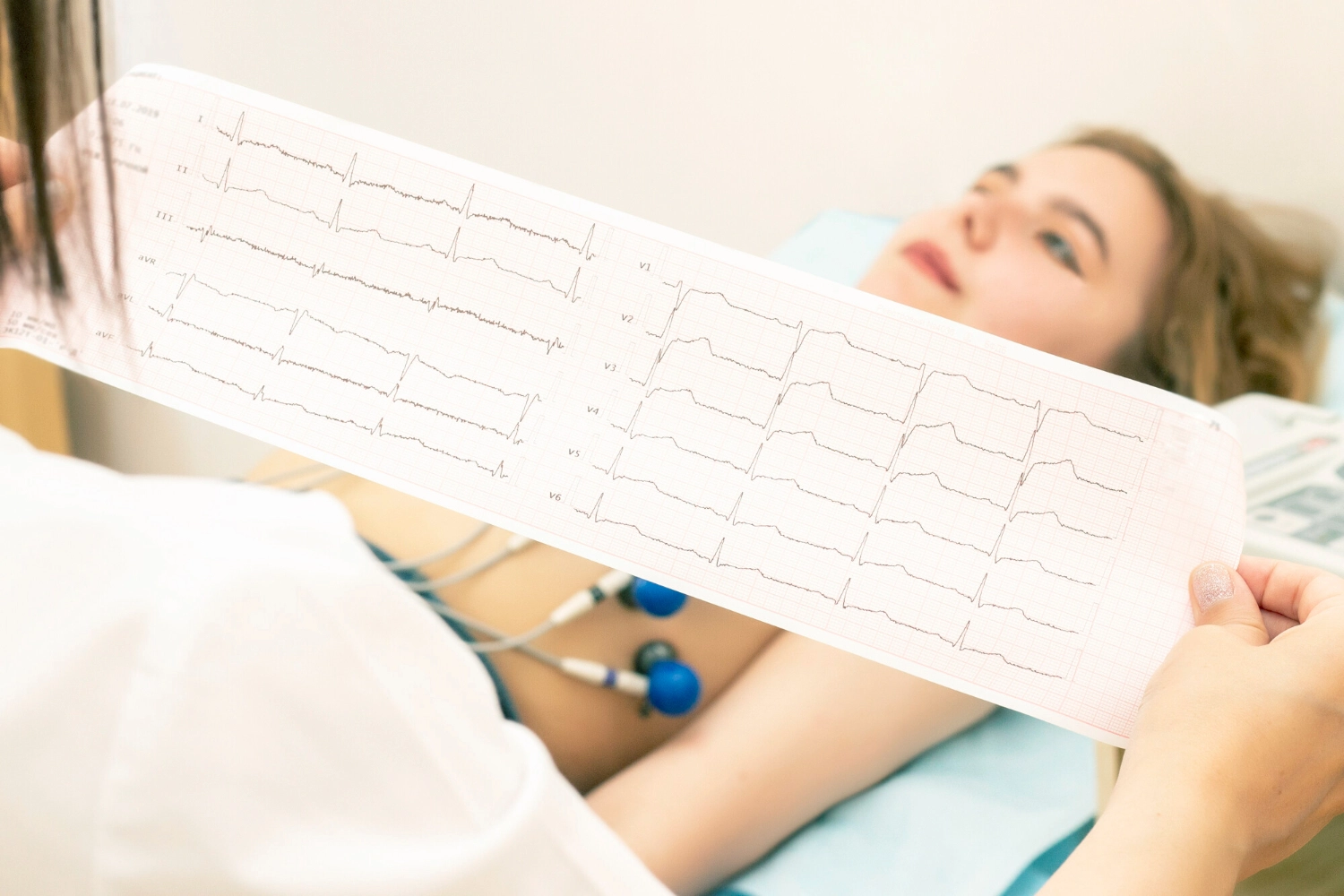 Electrocardiograma